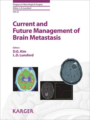cover image of Current and Future Management of Brain Metastasis